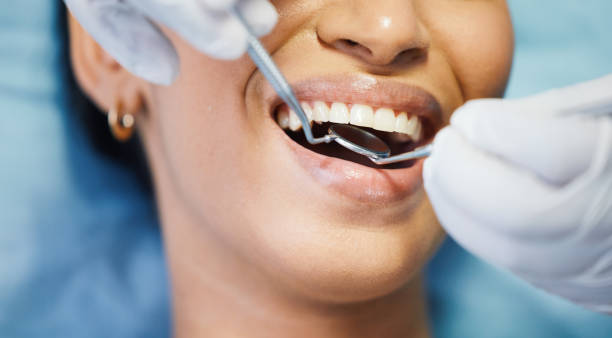 Best Broken or Cracked Tooth Emergency Dentist in Whitefish Bay, WI